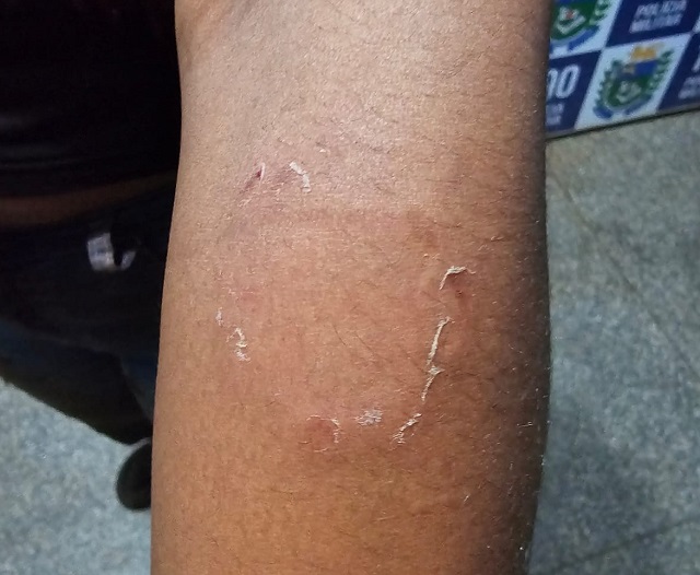 Homem é preso após morder e enforçar mulher em Ponta Porã